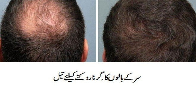 Dua For Hair Loss and Growth